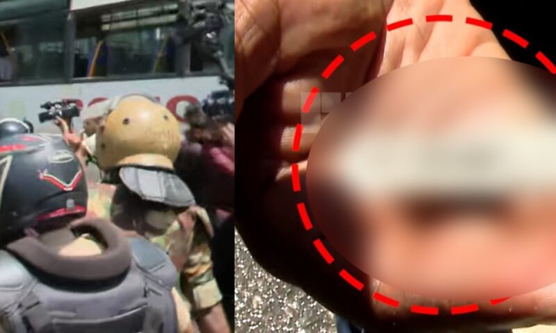 എസ്എഫ്ഐ സെക്രട്ടേറിയറ്റ് മാര്‍ച്ച്; ബ്ലേഡ് കൊണ്ടുവന്നത് എസ്എഫ്‌ഐയെന്ന് സ്പെഷ്യൽ ബ്രാഞ്ച് റിപ്പോർട്ട്